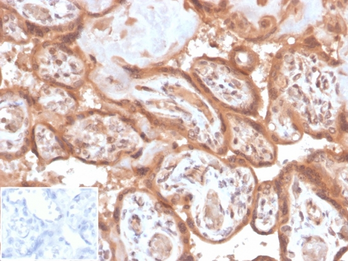 Anti-Fibroblast Activation Protein alpha Antibody [FAP/4853]