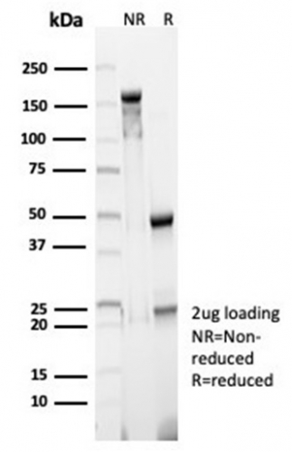 Anti-CD23 Antibody [FCER2/6890]