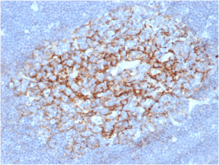 Anti-CD23 Antibody [FCER2/6891]