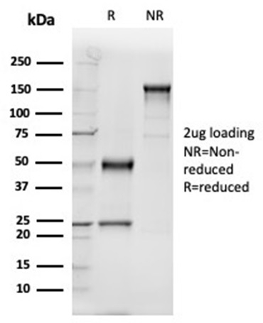 Anti-Vitamin D Binding Protein Antibody [VDBP/4481]