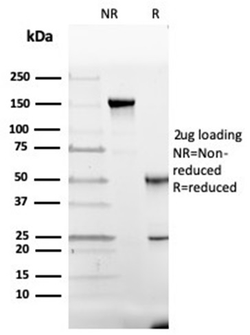 Anti-Vitamin D Binding Protein Antibody [VDBP/4482]