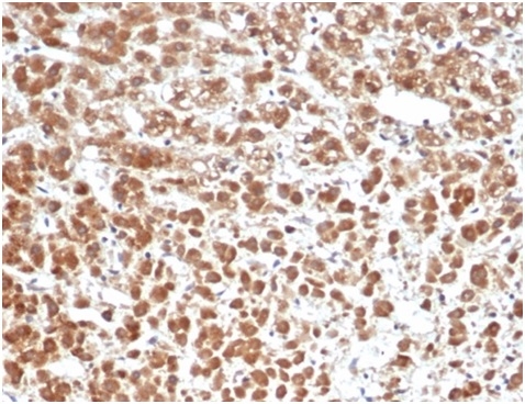 Anti-IL-1 beta Antibody [IL1B/6687]