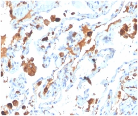 Anti-Surfactant Protein D Antibody [SFTPD/4363]