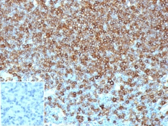 Anti-HLA DP + DQ + DR Antibody [HLA-Pan/6663]