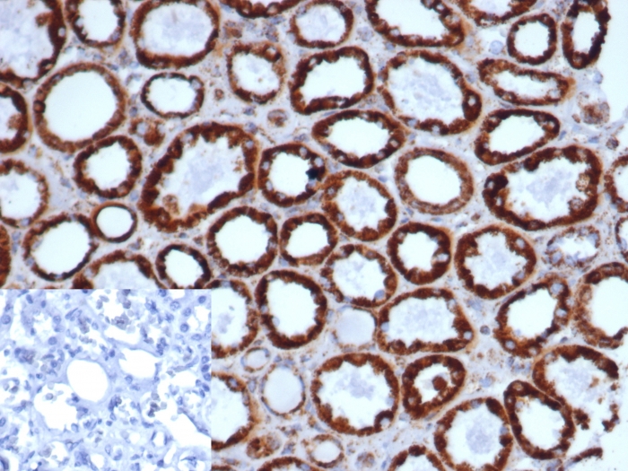 Anti-HSP60 Antibody [rHSPD1/6497]