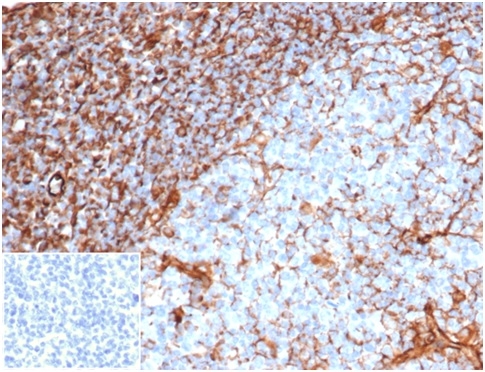 Anti-Vimentin Antibody [rVIM/6914]
