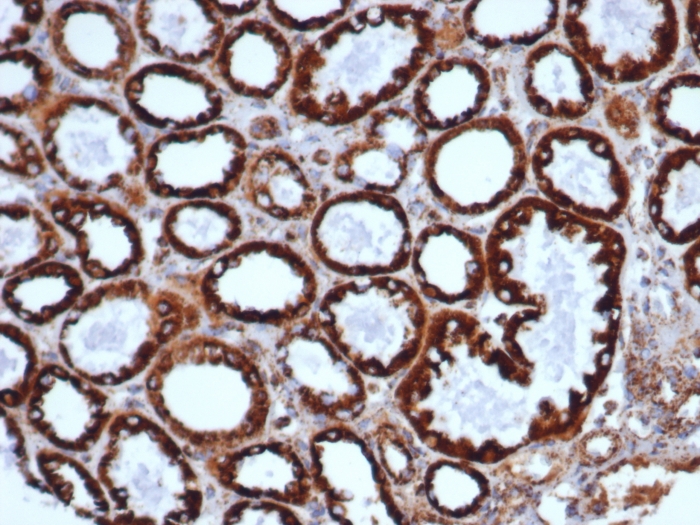 Anti-HSP60 Antibody [HSPD1/6498R]