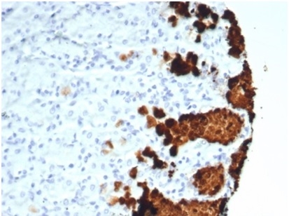Anti-Mucin 5AC Antibody [MUC5AC/7067R]