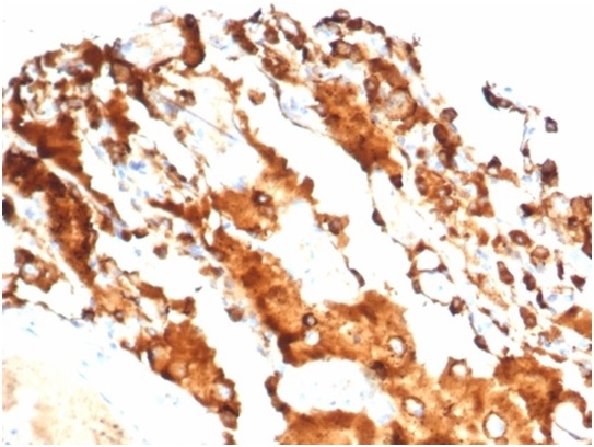 Anti-Surfactant Protein D Antibody [SFTPD/7084R]