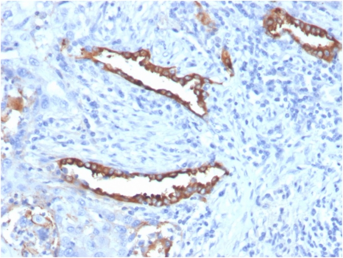 Anti-Surfactant Protein D Antibody [SFTPD/7085R]