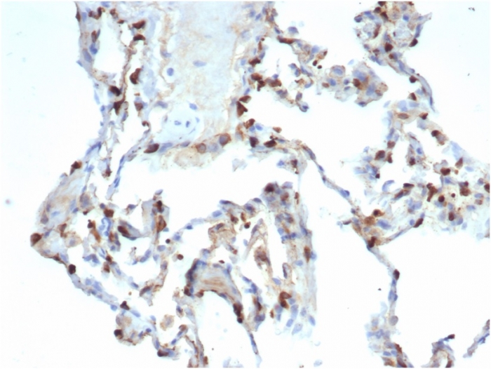 Anti-Surfactant Protein D Antibody [SFTPD/7086R]