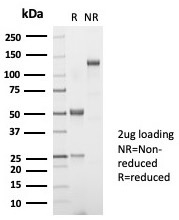 Anti-TSH beta Antibody [TSHb/7001R]