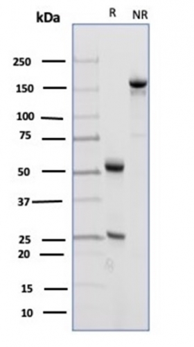 Anti-CD23 Antibody [FCER2/4918] - BSA and Azide free