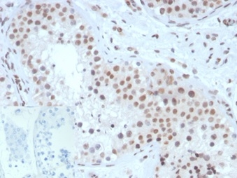 Anti-Steroidogenic Factor 1 Antibody [NR5A1/3420] - BSA and Azide free