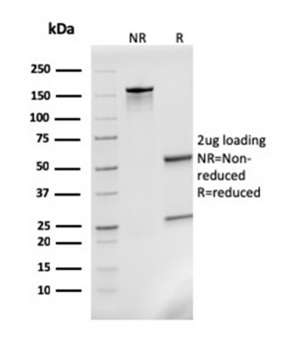 Anti-MCP2 Antibody [CCL8/3311] - BSA and Azide free