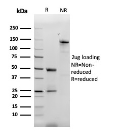 Anti-MCP2 Antibody [CCL8/3312] - BSA and Azide free