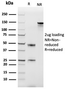 Anti-MCP2 Antibody [CCL8/3686] - BSA and Azide free