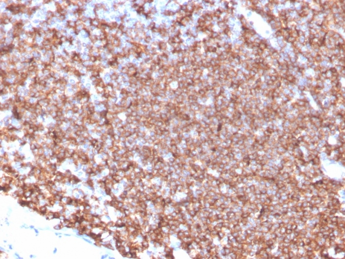 Anti-CD20 Antibody [MS4A1/4655] - BSA and Azide free