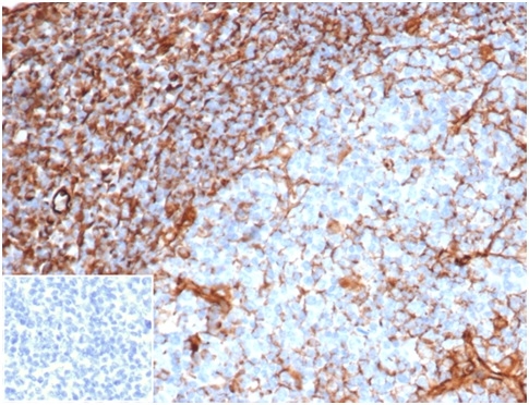 Anti-Vimentin Antibody [rVIM/6914] - BSA and Azide free