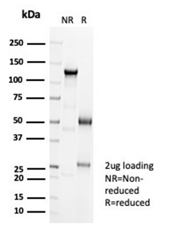 Anti-Cadherin 16 Antibody [CDH16/7027R] - BSA and Azide free