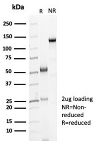 Anti-Cadherin 16 Antibody [CDH16/7028R] - BSA and Azide free