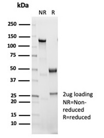 Anti-IL-1 beta Antibody [IL1B/7049R] - BSA and Azide free