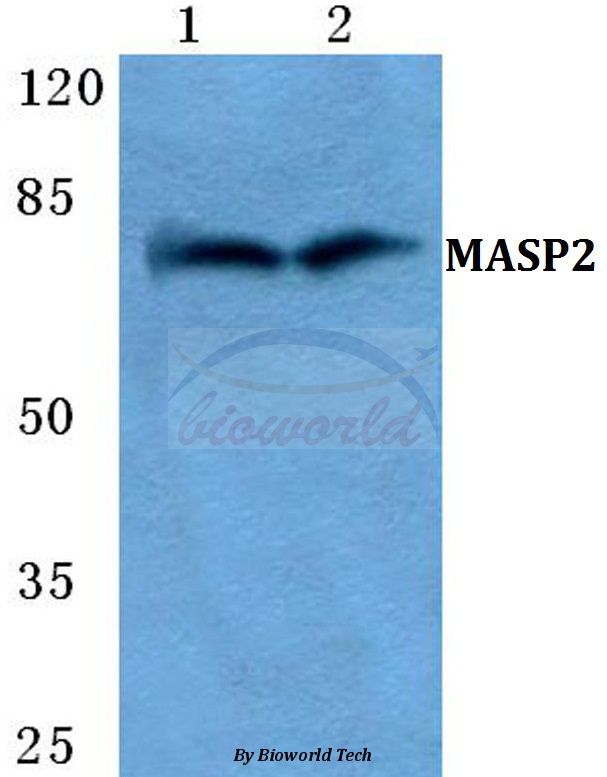 Anti-MASP2 Antibody