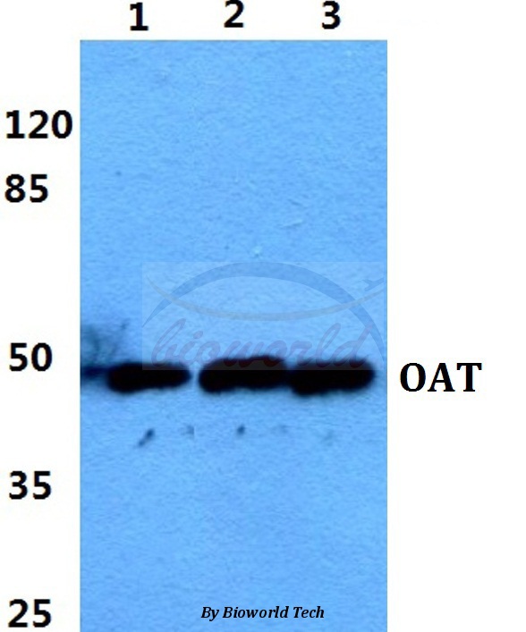 Anti-OAT Antibody