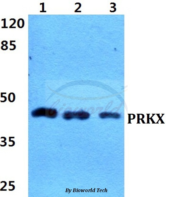 Anti-PRKX Antibody