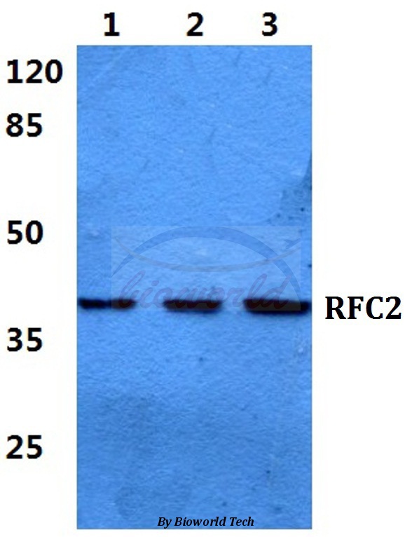 Anti-RFC2 Antibody