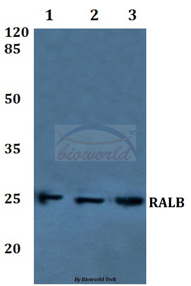 Anti-RALB Antibody