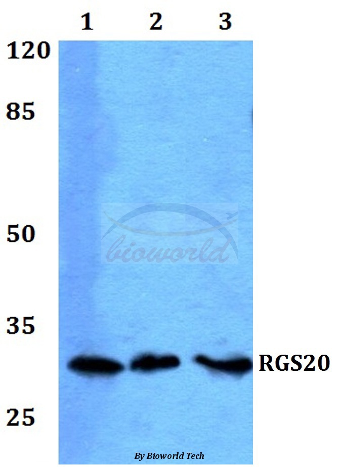 Anti-RGS20 Antibody