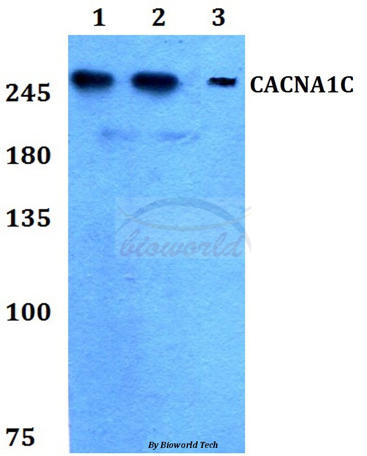 Anti-CACNA1C Antibody