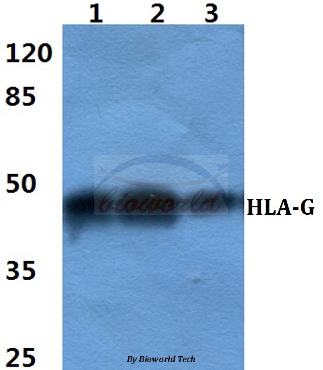 Anti-HLA-G Antibody