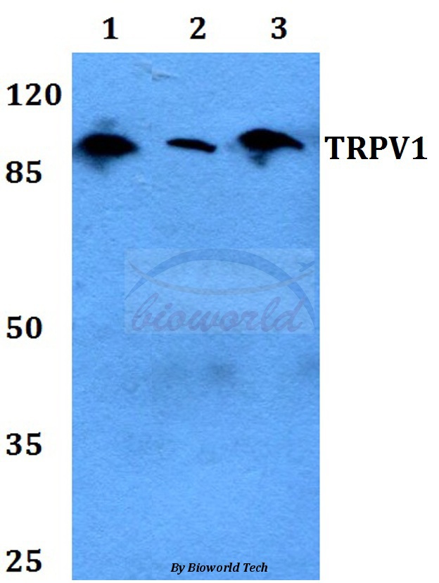 Anti-TRPV1 Antibody