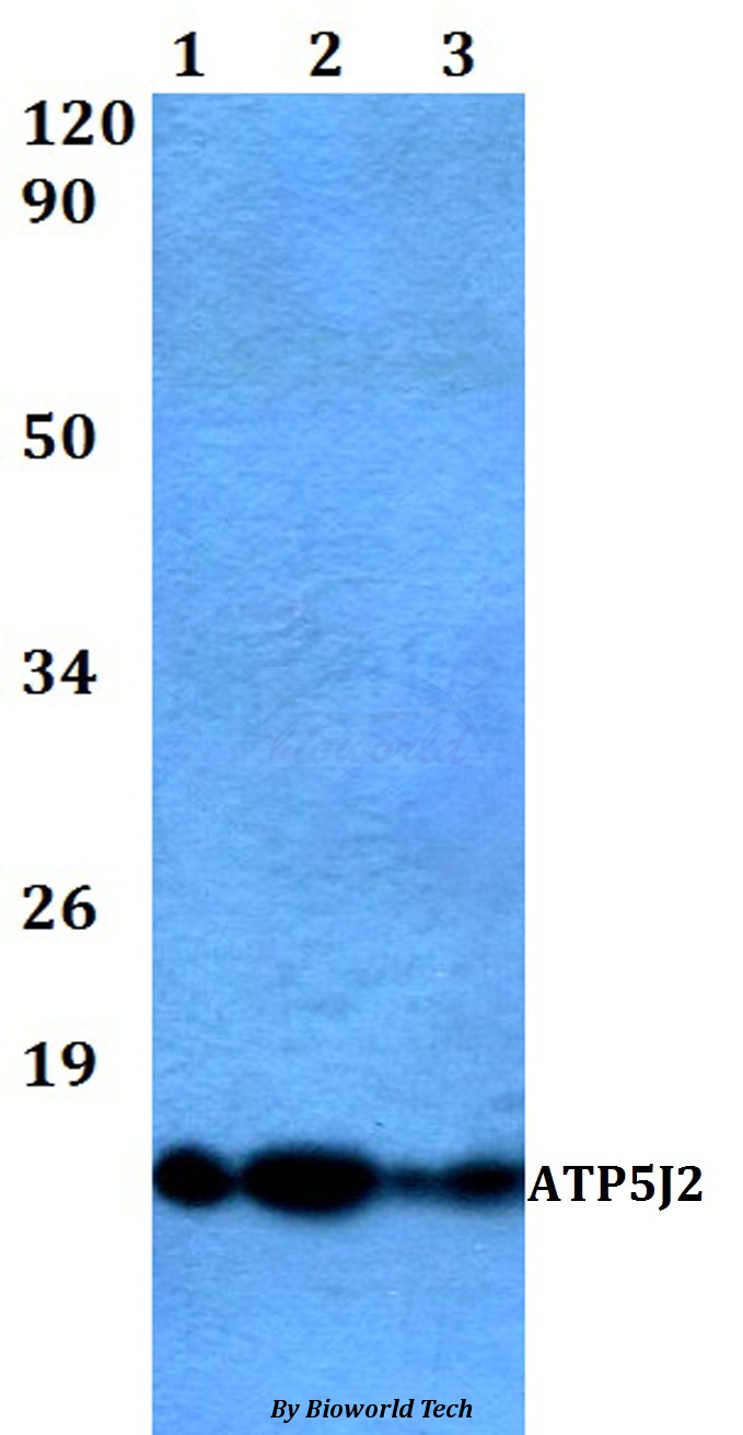 Anti-ATP5J2 Antibody