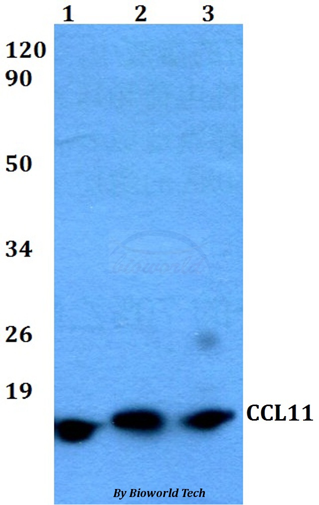 Anti-CCL11 Antibody