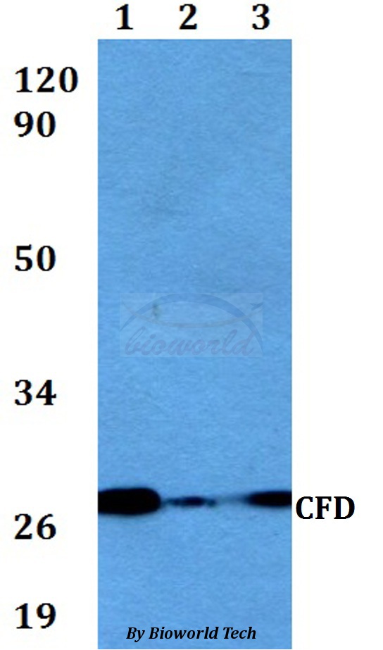 Anti-CFD Antibody