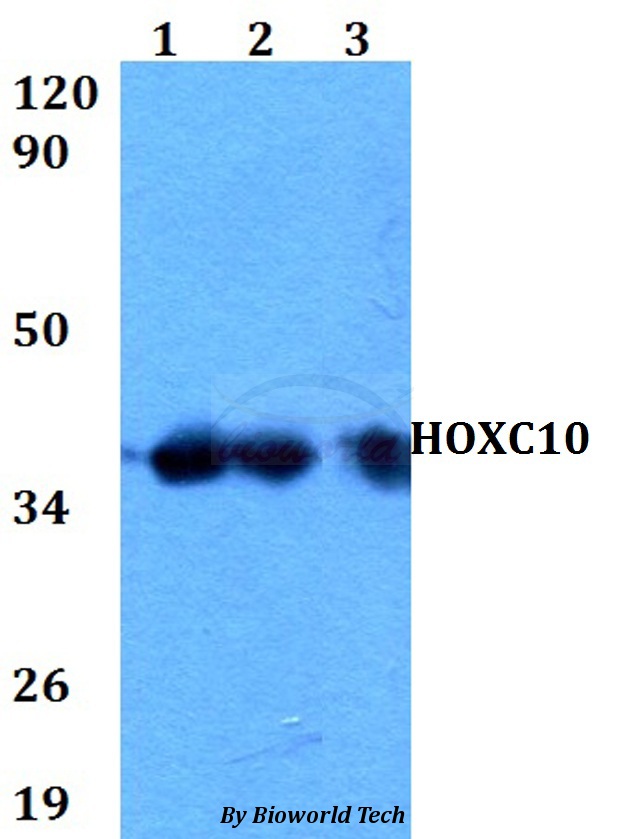 Anti-HOXC10 Antibody