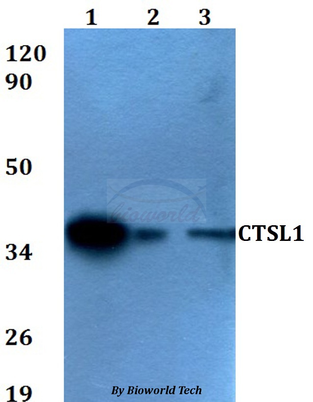 Anti-CTSL1 Antibody