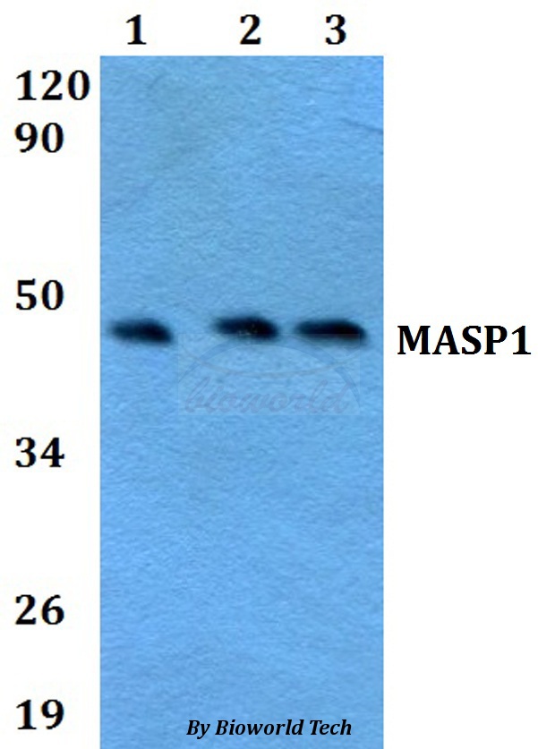 Anti-MASP1 Antibody