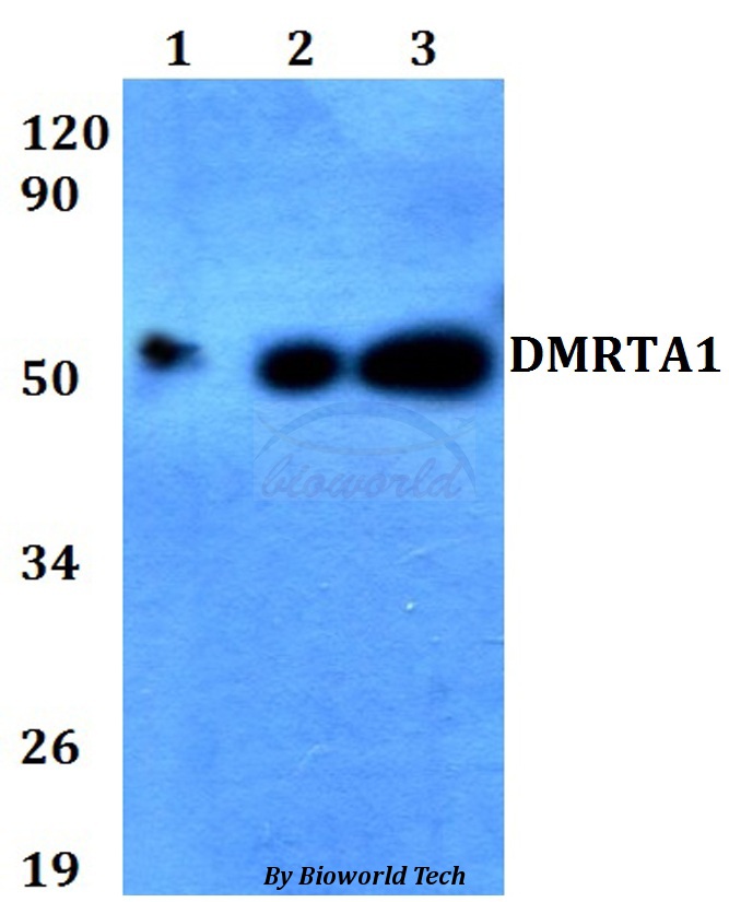 Anti-DMRTA1 Antibody