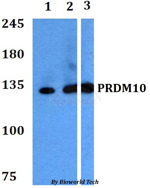 Anti-PRDM10 Antibody