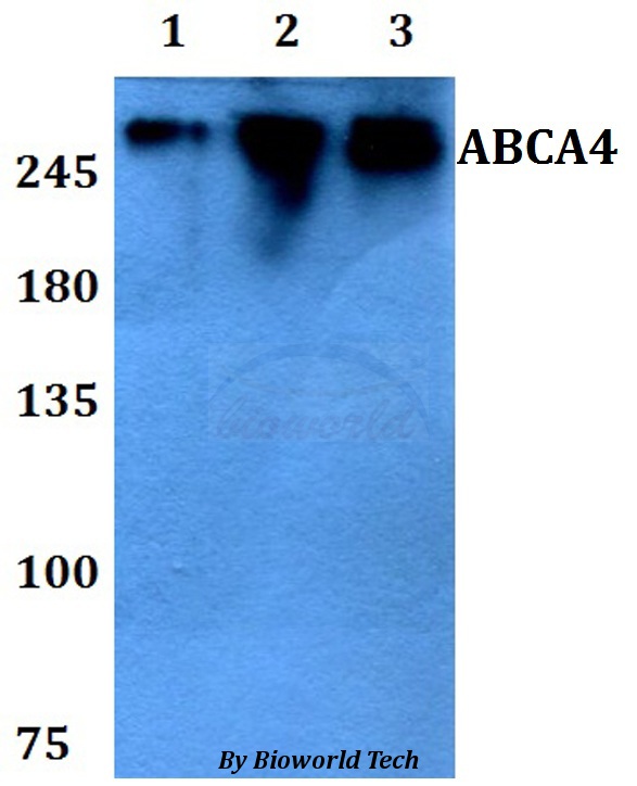 Anti-ABCA4 Antibody