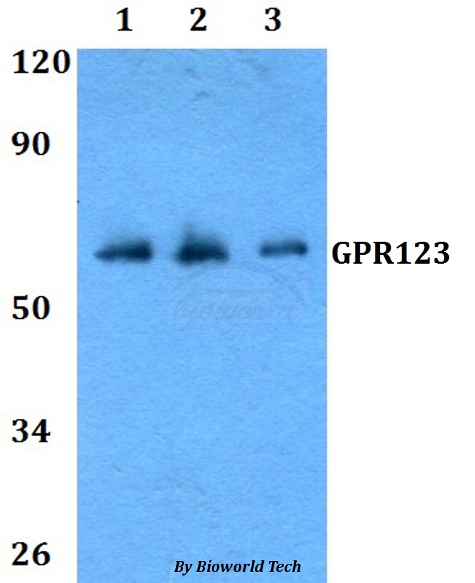 Anti-GPR123 Antibody