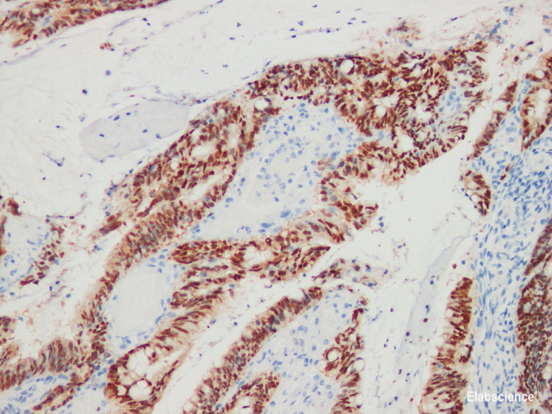 Anti-CDX-2 Antibody [YN00475m]