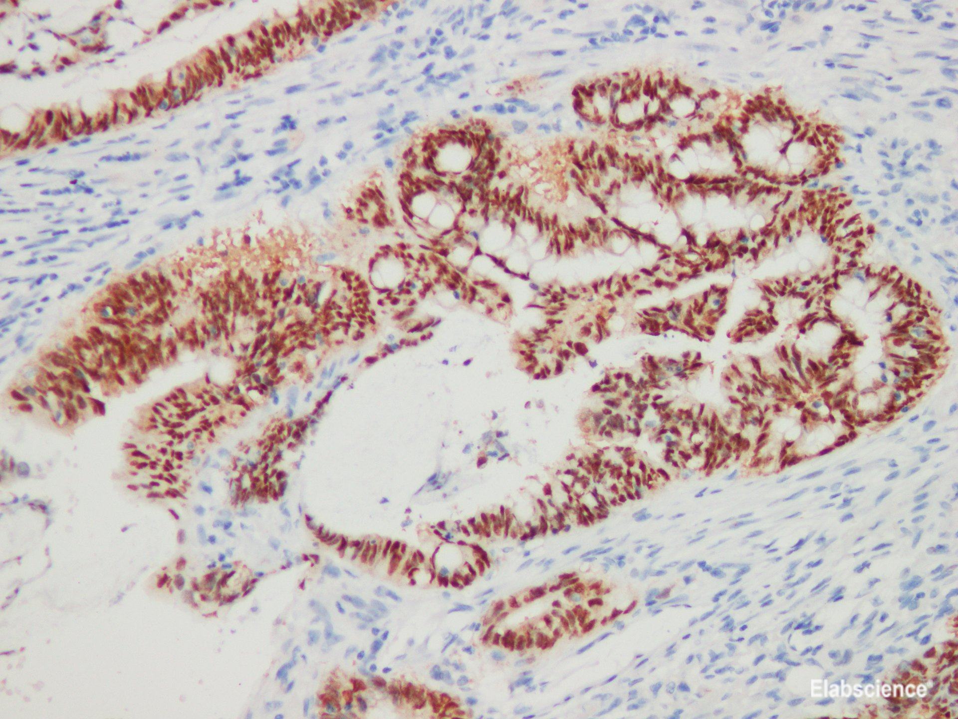 Anti-CDX-2 Antibody [YN00475r]