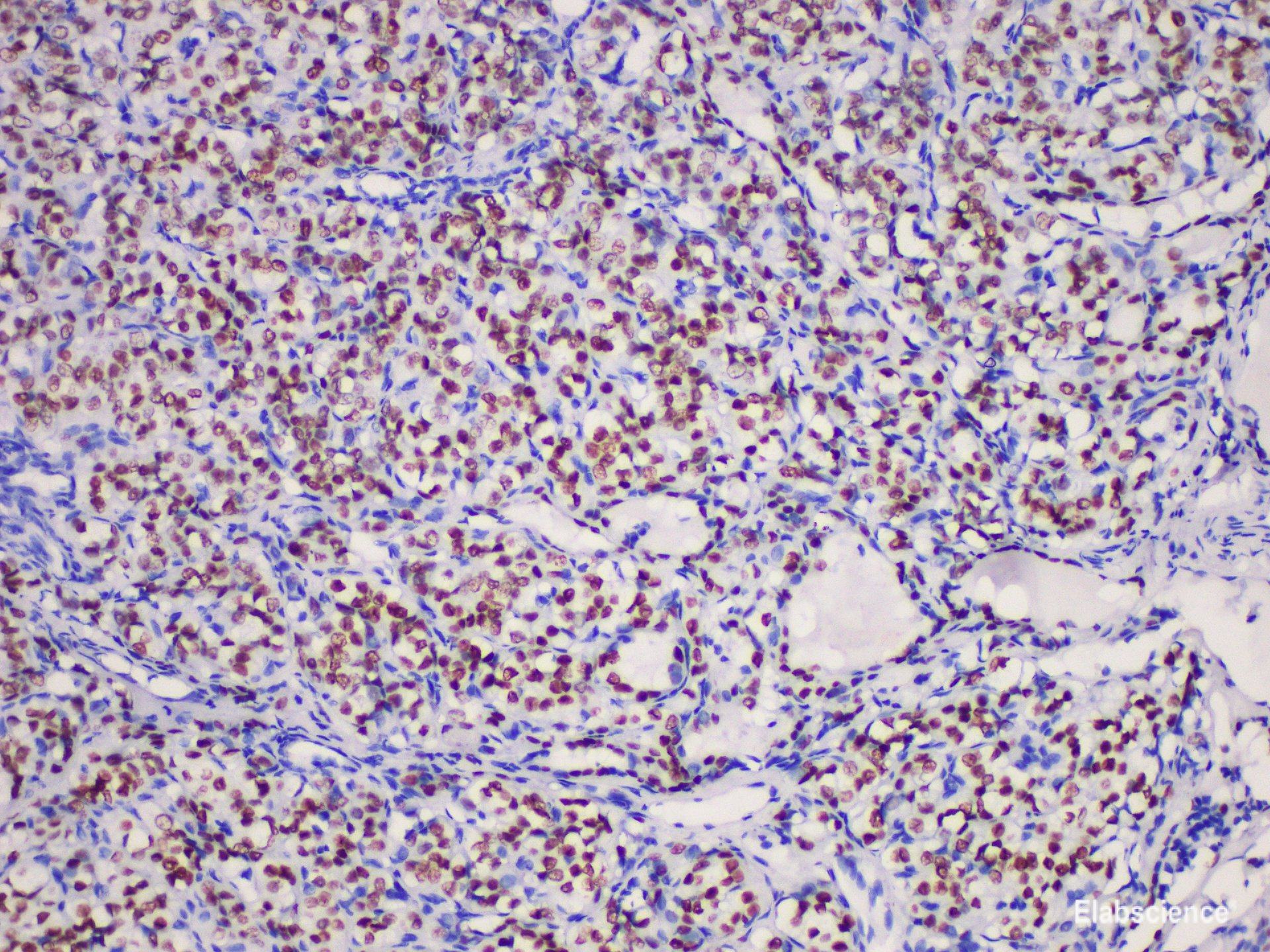 Anti-Thyroid transcription factor-1(TTF1) Antibody [YN01606m]
