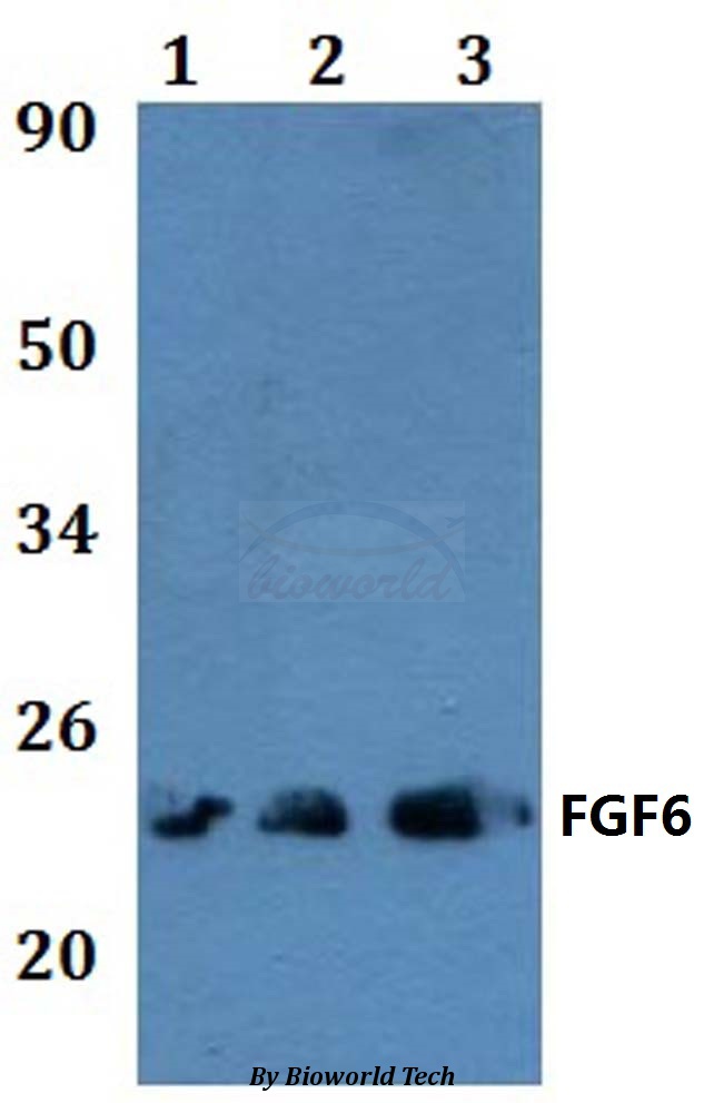Anti-FGF6 Antibody