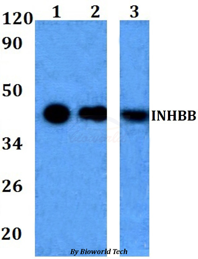 Anti-INHBB Antibody